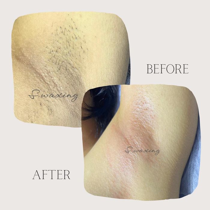 Hình ảnh phòng wax tiêu chuẩn tại S.waxing