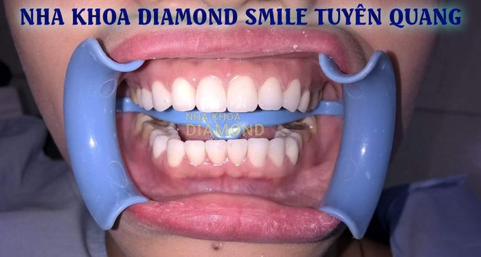 Không gian hiện đại tại Nha khoa Diamond Smile