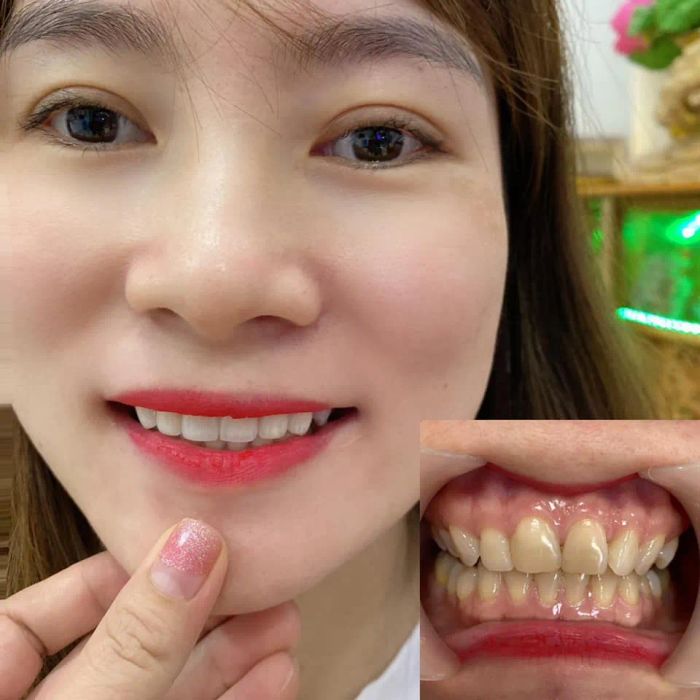 Không gian hiện đại tại Nha khoa Thẩm Mỹ Happy