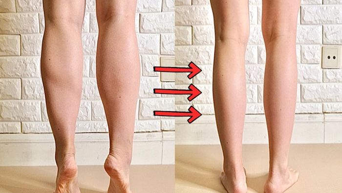 Giảm mỡ đùi với kem tan mỡ ảnh 2