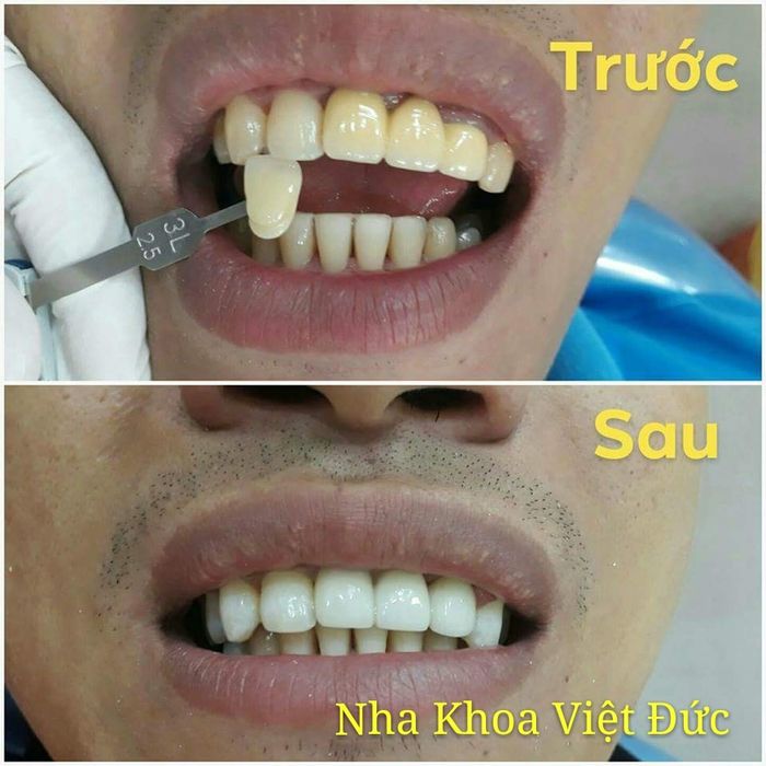Hình ảnh Nha khoa Việt Đức