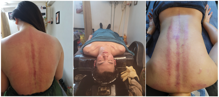 goi dau duong sinh quan Hoan Kiem 2.png