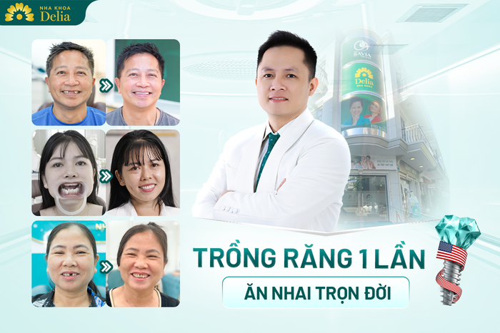 Dia Chi Trong Rang Implant Uy Tin Hang Dau Tai Thanh Hoa 3.png
