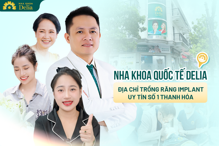 Dia Chi Trong Rang Implant Uy Tin Hang Dau Tai Thanh Hoa.png