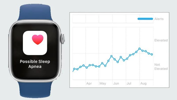 Apple-Watch-2