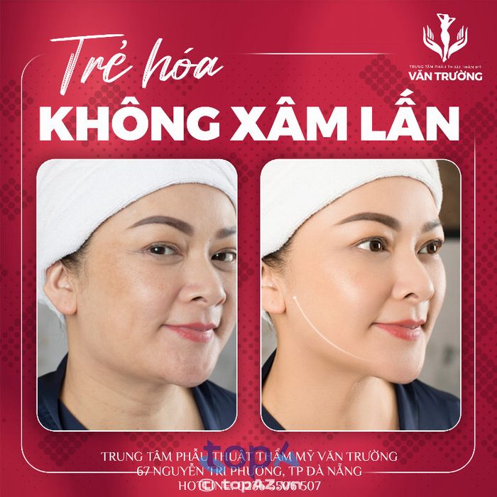 Thẩm mỹ viện Văn Trường
