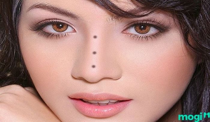 Nốt ruồi ở sống mũi