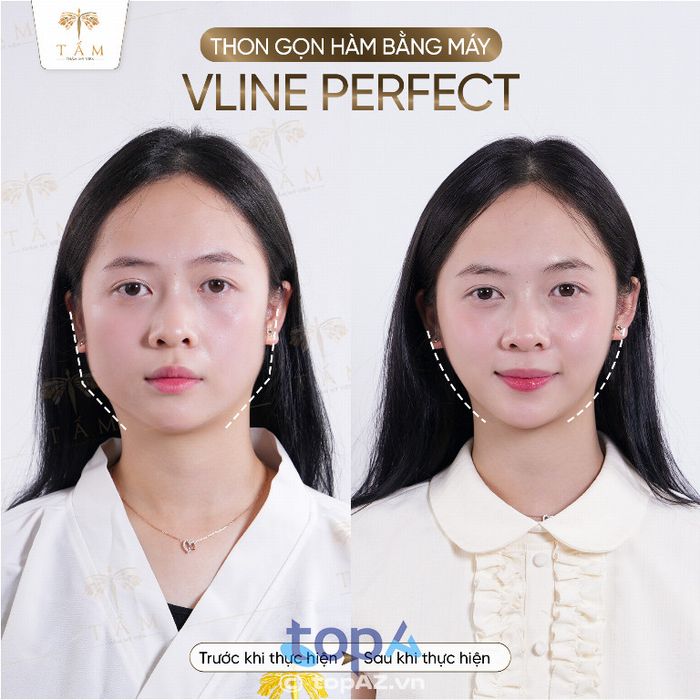 Thẩm mỹ viện Tấm