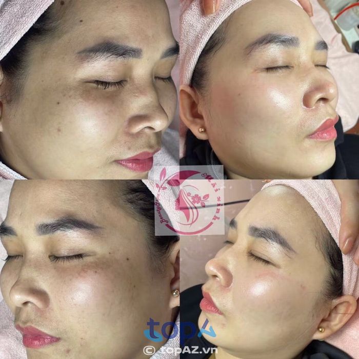 Mãi Xinh BeautySpa