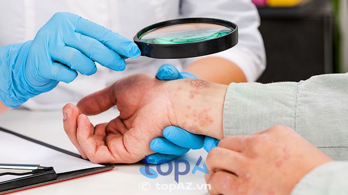 Việc chẩn đoán chính xác rất quan trọng để lựa chọn phương pháp điều trị hiệu quả