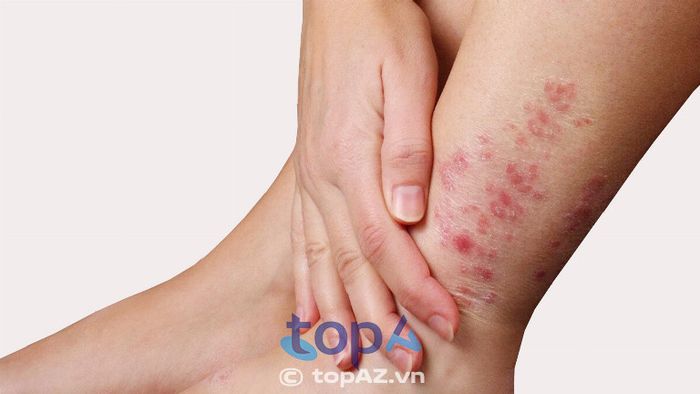 Phương pháp điều trị chuẩn y học đã được kiểm nghiệm