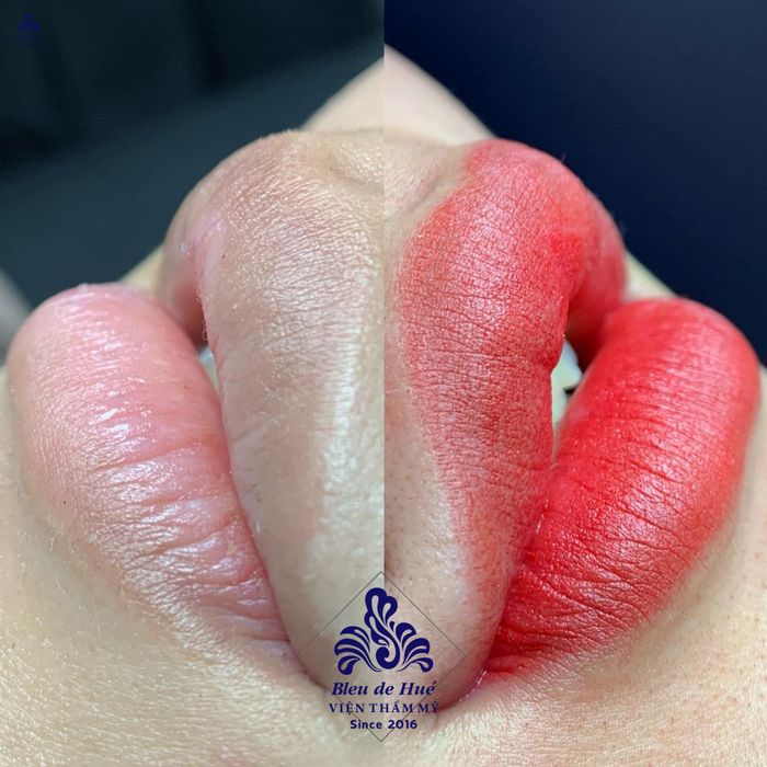 Ảnh 1 của Viện Thẩm mỹ Bleu de Hué