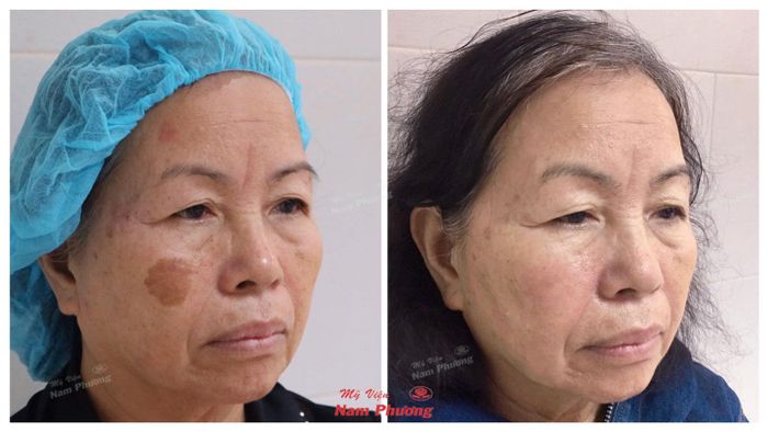 Ảnh 1 của Thẩm Mỹ Viện Nam Phương