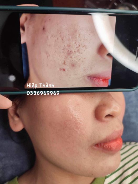 Ảnh 1 của Thẩm Mỹ Công Nghệ Cao Hiệp Thành