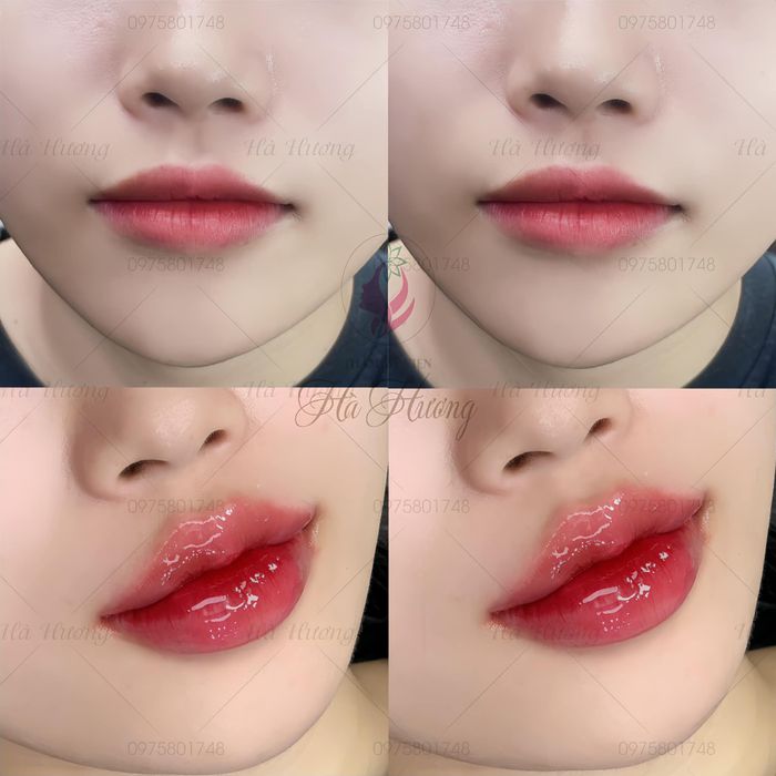 Thẩm Mỹ Viện Hà Hương - Hình ảnh 1