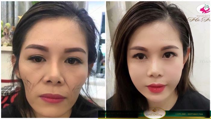 Thẩm Mỹ Viện Hà Hương - Hình ảnh 2