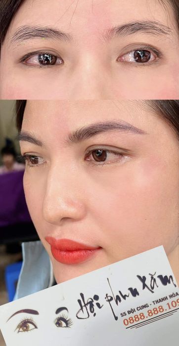 Thẩm Mỹ Viện Beauty Hà Nội - Thanh Hoá - Hình ảnh 1