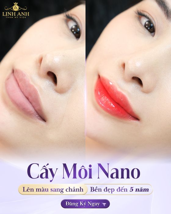 Viện Thẩm Mỹ Quốc Tế Linh Anh - Hình ảnh 1