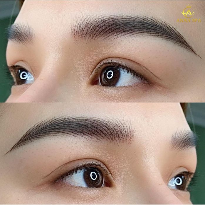 Viện Thẩm Mỹ ANNA - Hình ảnh 1