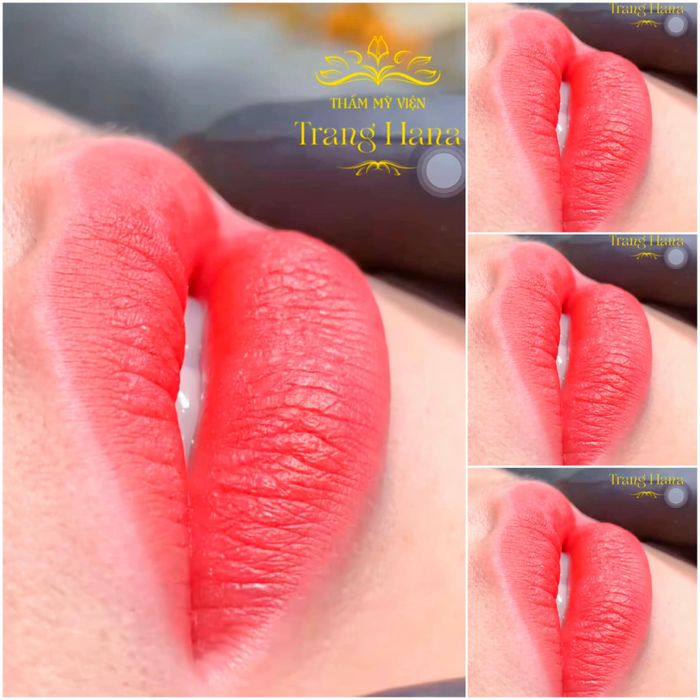 Thẩm Mỹ Viện Trang Hana hình ảnh 2