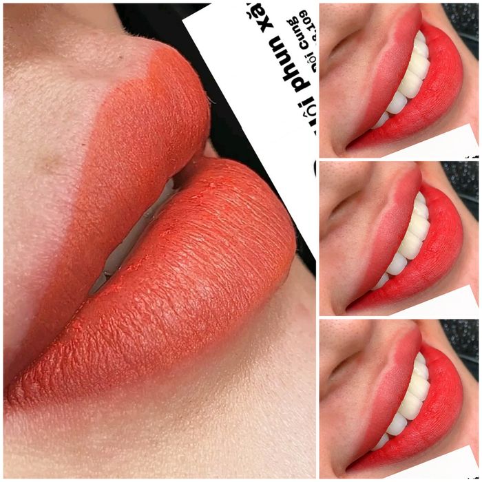 Thẩm Mỹ Viện Beauty Hà Nội - Thanh Hoá - Hình ảnh 2