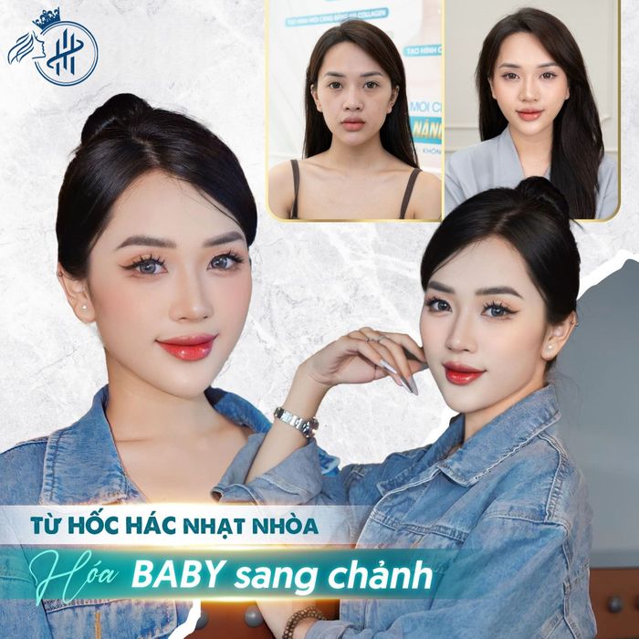 Thẩm Mỹ Viện Quốc Tế Thu Hằng - Hình ảnh 1