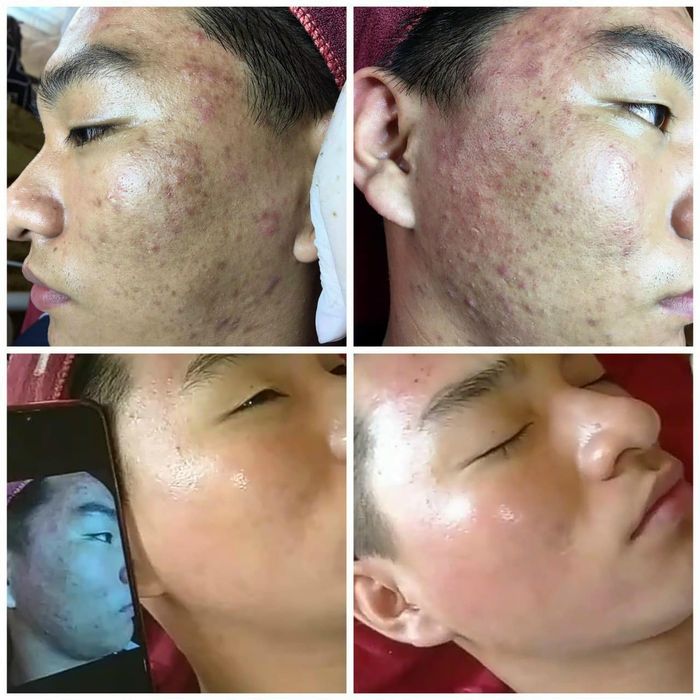 Thẩm Mỹ Viện Hà Tuyên - Hình ảnh 1