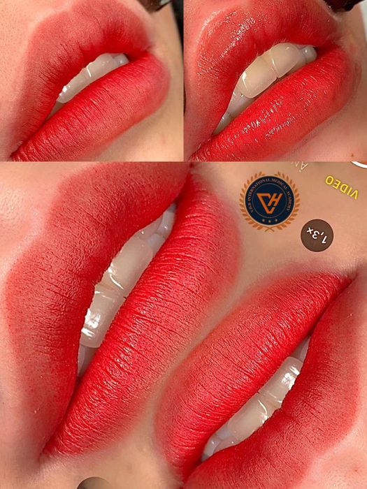 Thẩm Mỹ Viện Việt Hàn - Hình ảnh 2