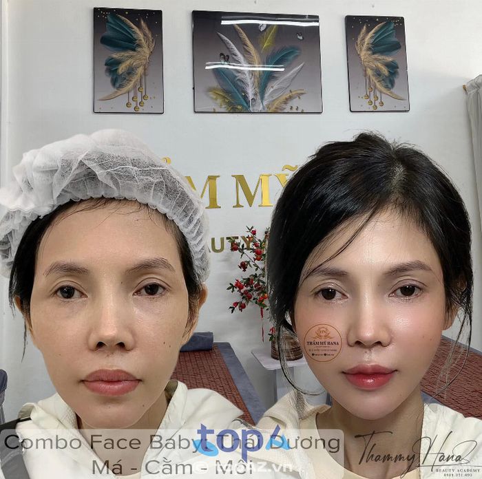 Thẩm Mỹ Hana