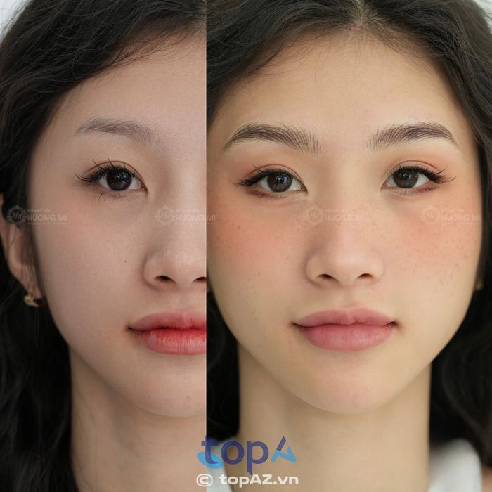 Thẩm Mỹ Viện Hương Mi