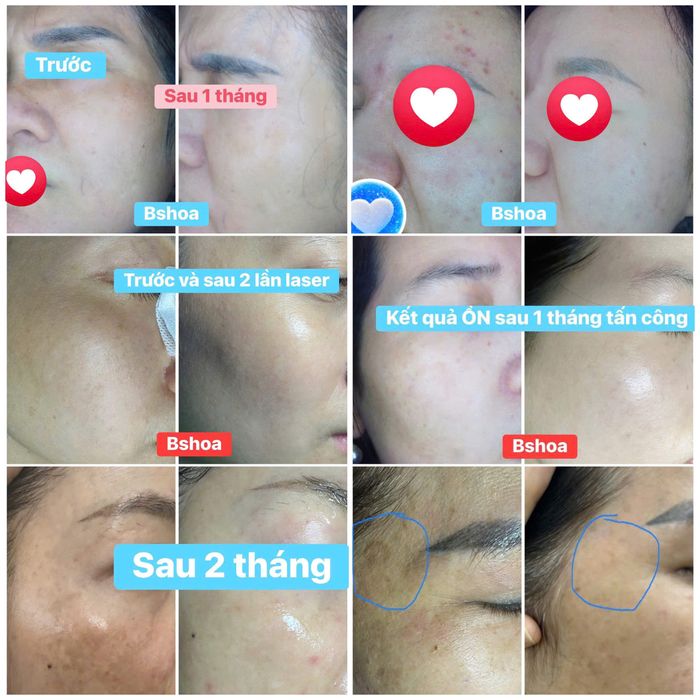 phong-kham-da-lieu-uy-tin-tai-quang-nam 2.jpg