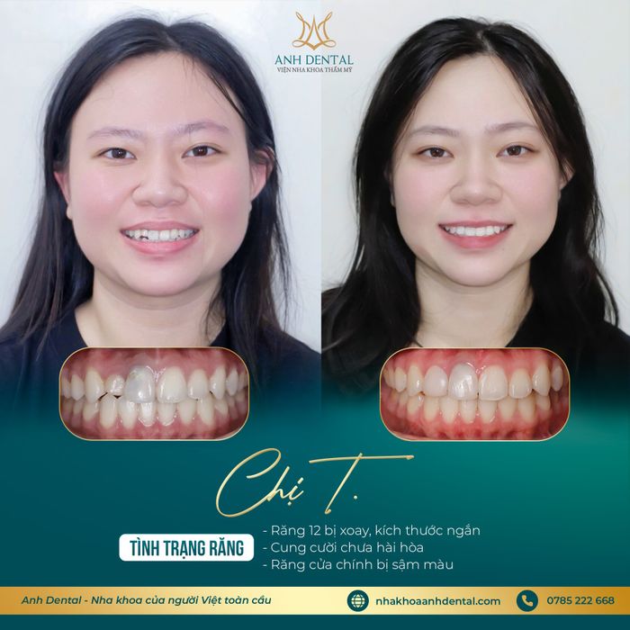 Nha khoa thẩm mỹ Anh Dental - Hình ảnh 2