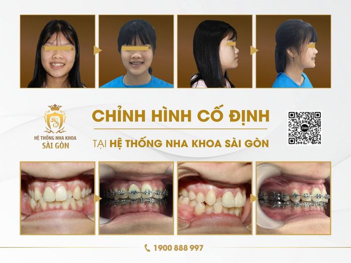 Hình ảnh Nha Khoa Sài Gòn - Chi nhánh Vị Thanh 2