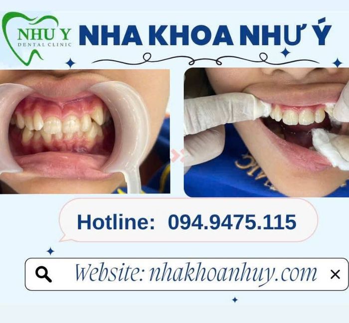 Nha Khoa Như Ý - Hình ảnh 3