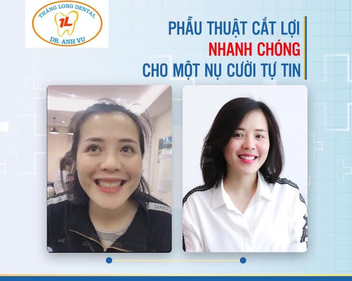 Nha khoa Thăng Long - BS Nguyễn Anh Vũ - Hình ảnh 3