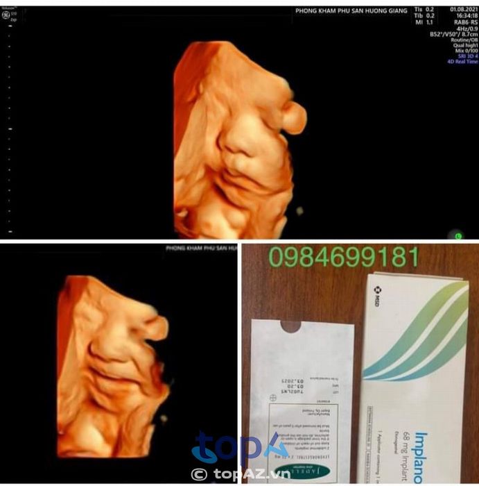 Phòng khám phụ sản Hương Giang – Tứ Kỳ