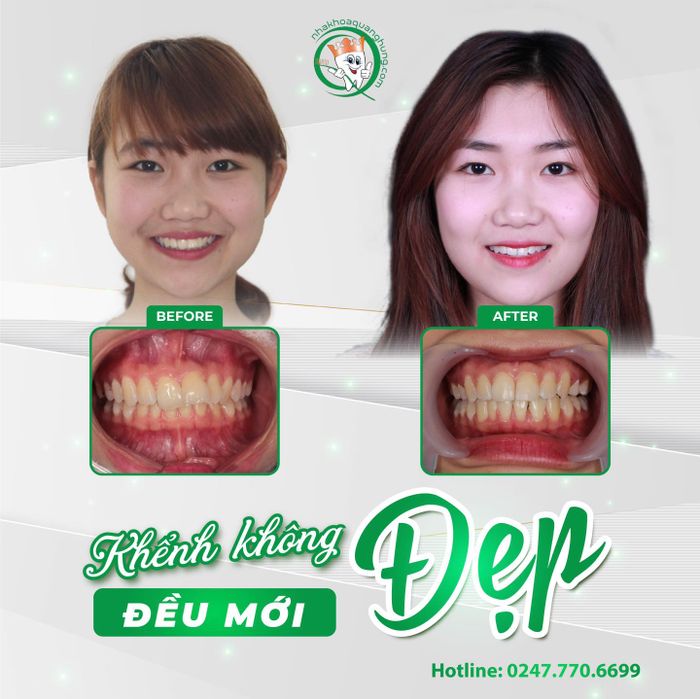 Nha khoa Quang Hưng - Hình ảnh 3