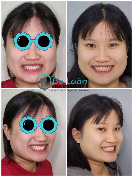 Nha khoa Mỹ Ý hình ảnh 3