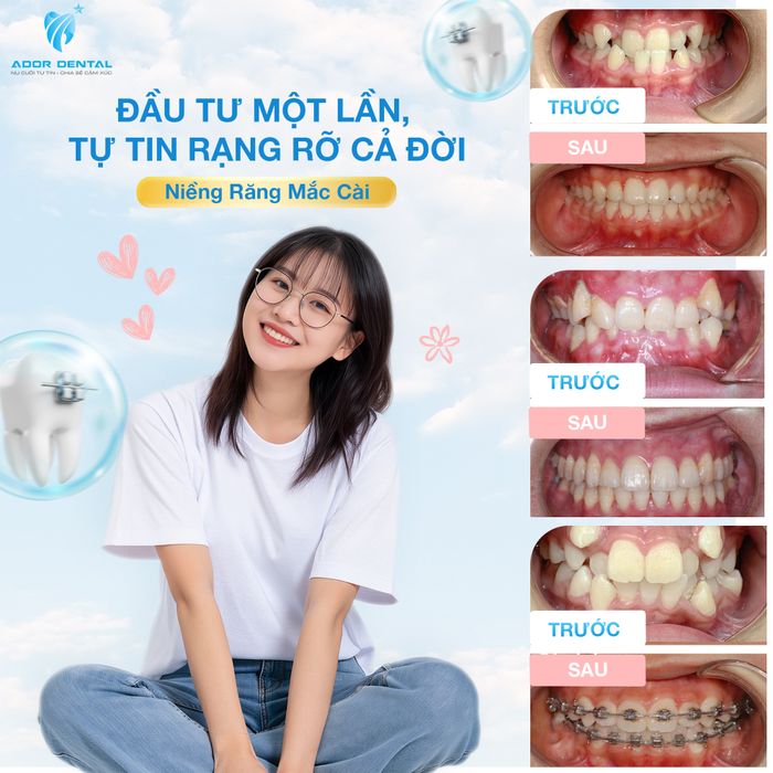 Ador Dental – Nha Khoa Thẩm Mỹ Quốc Tế hình ảnh 2