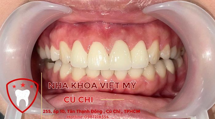 Nha Khoa Việt Mỹ Củ Chi hình ảnh 2