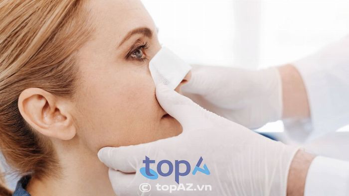 Ưu tiên chọn bác sĩ có kinh nghiệm chuyên sâu về chỉnh sửa mũi