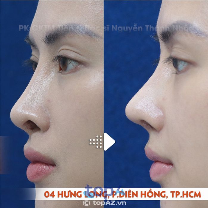 PK CK Phẫu Thuật Thẩm Mỹ TS. BS. Nguyễn Thành Nhân - P. Diên Hồng