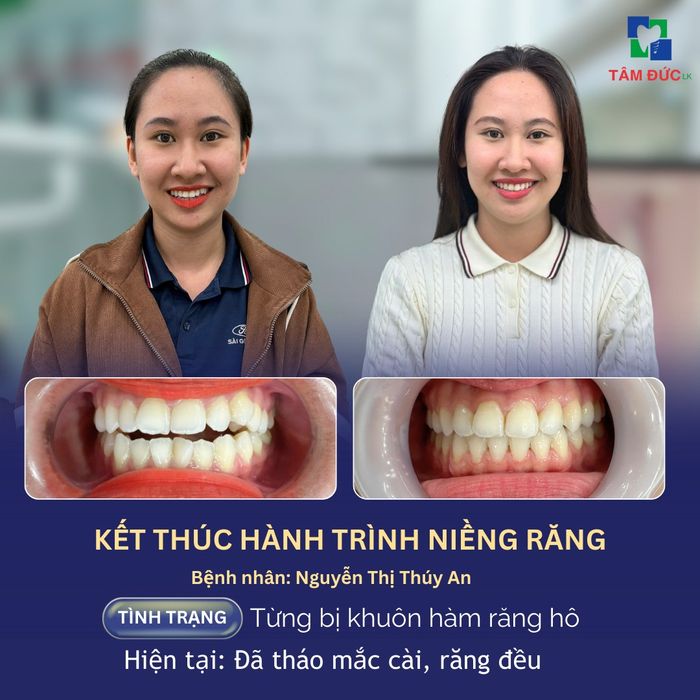 Nha Khoa Tâm Đức hình ảnh 2