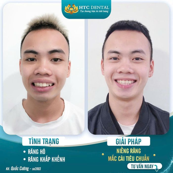 Nha Khoa HTC - Viện nha khoa thẩm mỹ Hải Dương ảnh 1