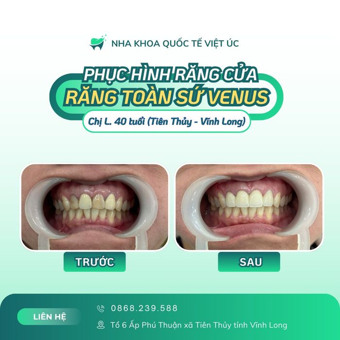 Ảnh của Nha Khoa Việt Úc Bến Tre - Hình 2