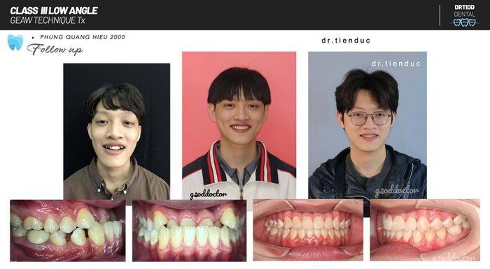 Ảnh 2 của Nha Khoa Tiến Đức (Drtidd Dental Clinic)