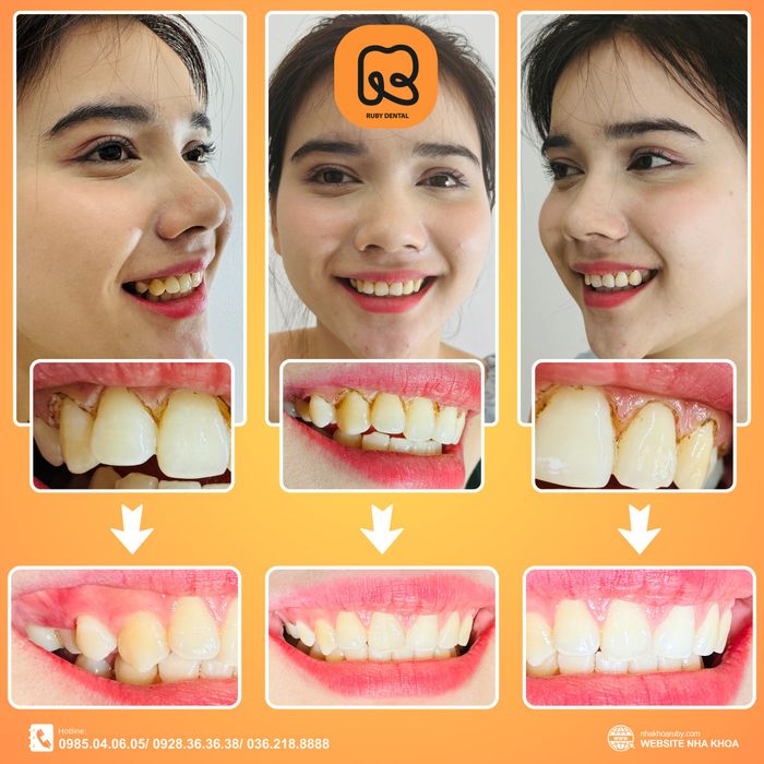 Nha Khoa Quốc Tế Ruby Dental hình ảnh 2