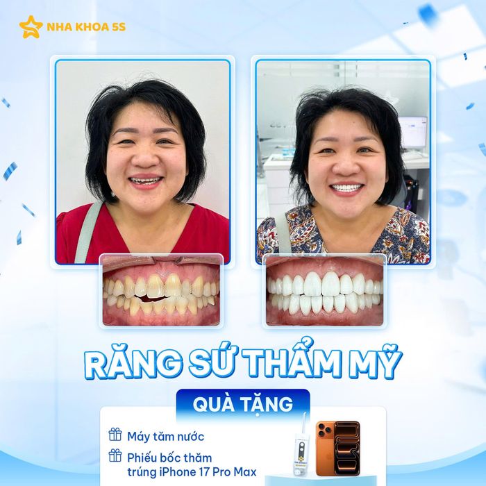 Hình ảnh Nha Khoa 5S 2