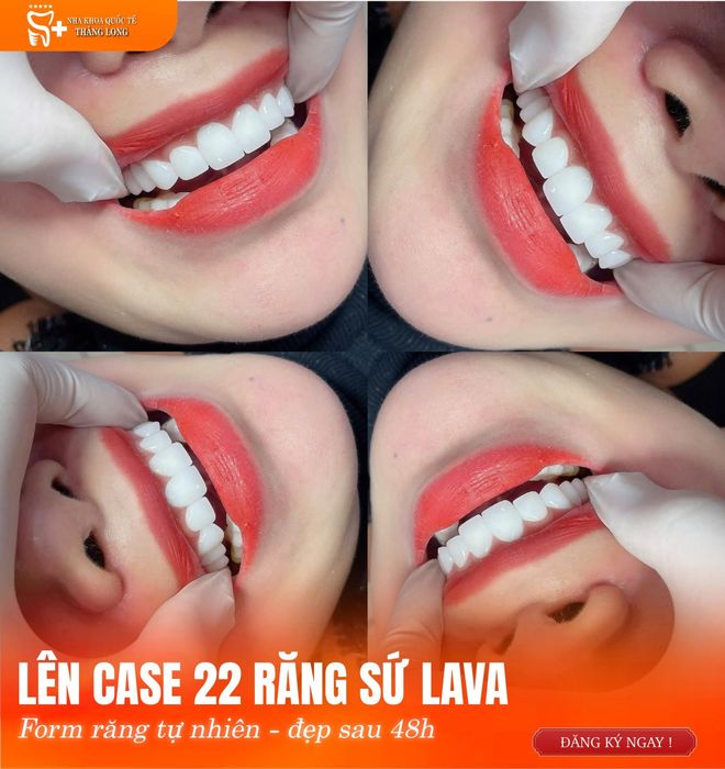 Hình ảnh Nha Khoa Quốc Tế Thăng Long - Mỹ Tho 1