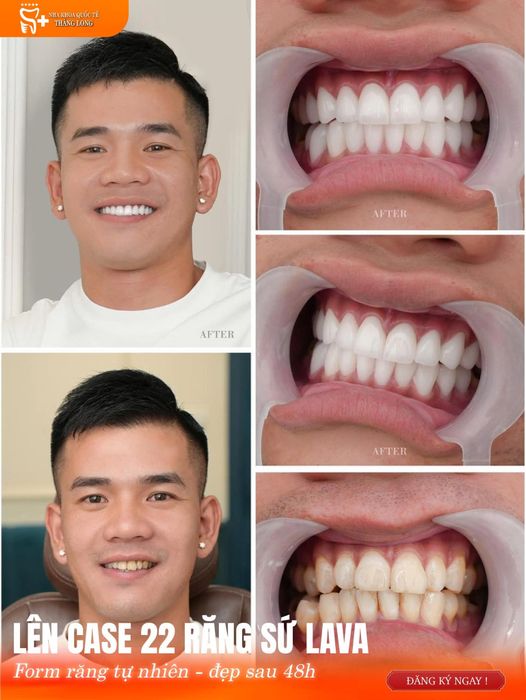 Hình ảnh Nha Khoa Quốc Tế Thăng Long - Mỹ Tho 2
